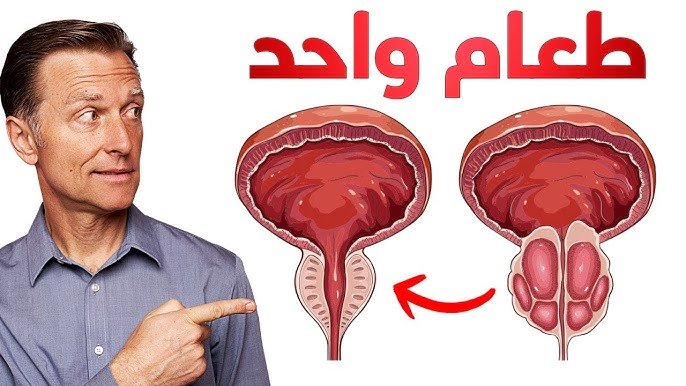 سرطان البروستات: العلاج في الطعام