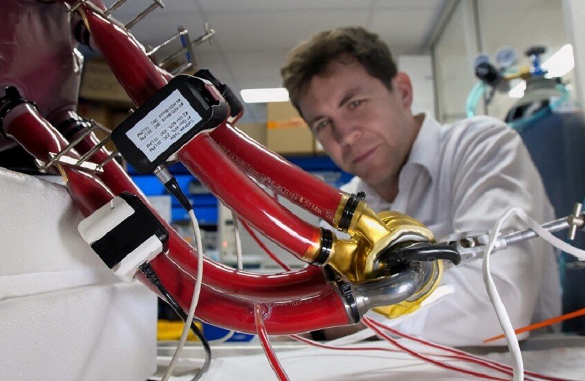 أسترالي عاش بقلب صناعي 100 يوم